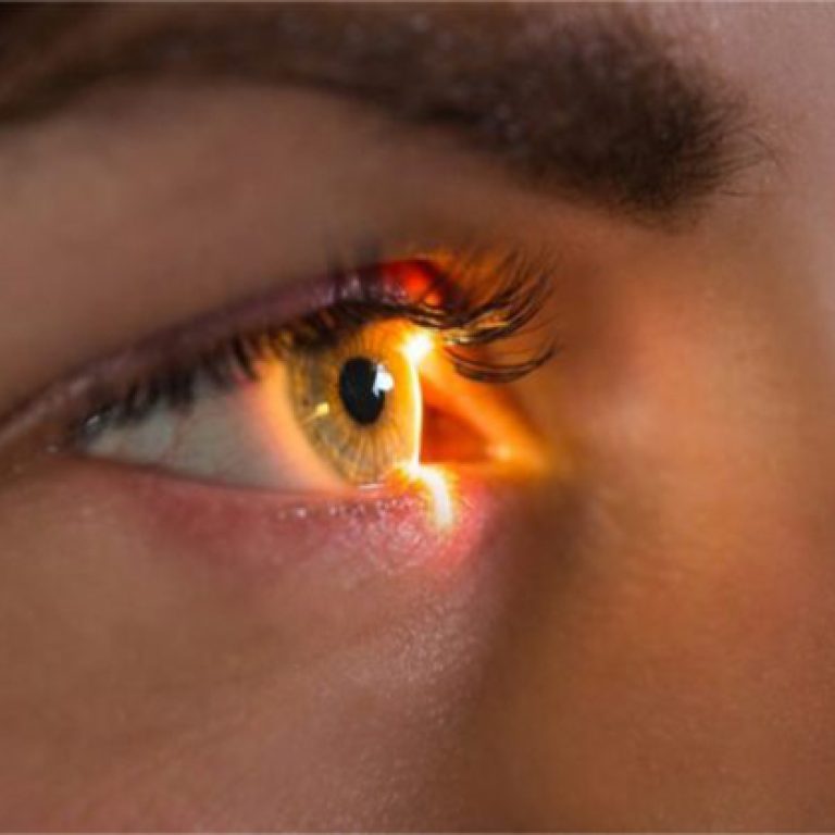 benh-hac-vong-mac-trung-tam