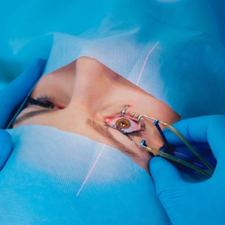 Bien-chung-phau-thuat-duc-thuy-tinh-the