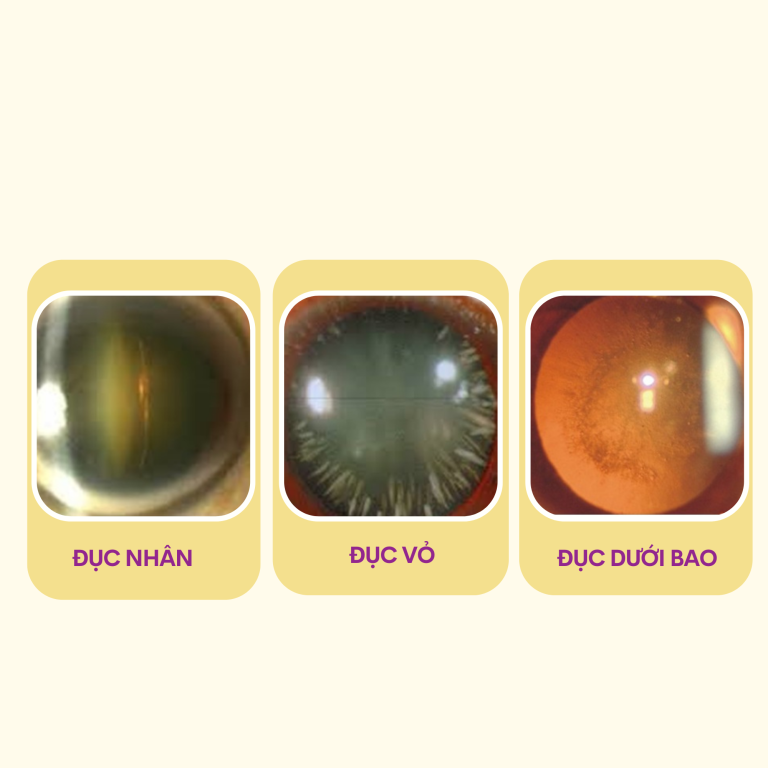 CAC-DANG-DUC-THUY-TINH-THE