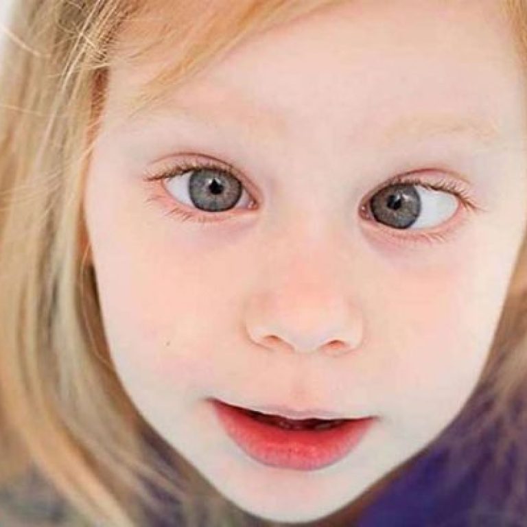 Can-thi-o-tre-em-co-nguy-hiem-khong