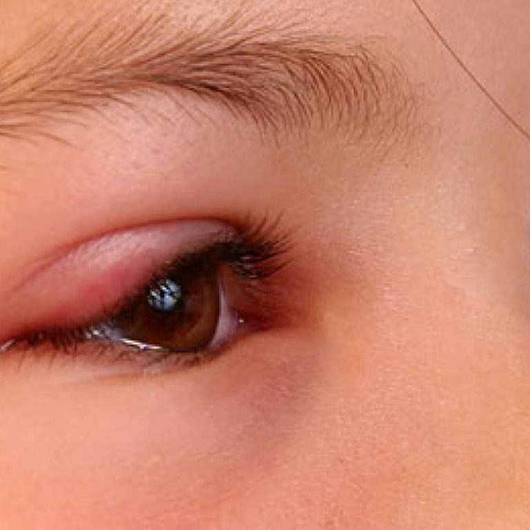 Chap-mat-tre-em-co-nguy-hiem-khong