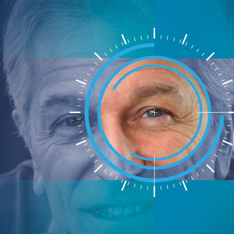 duc-thuy-tinh-the-co-can-phai-mo-khong