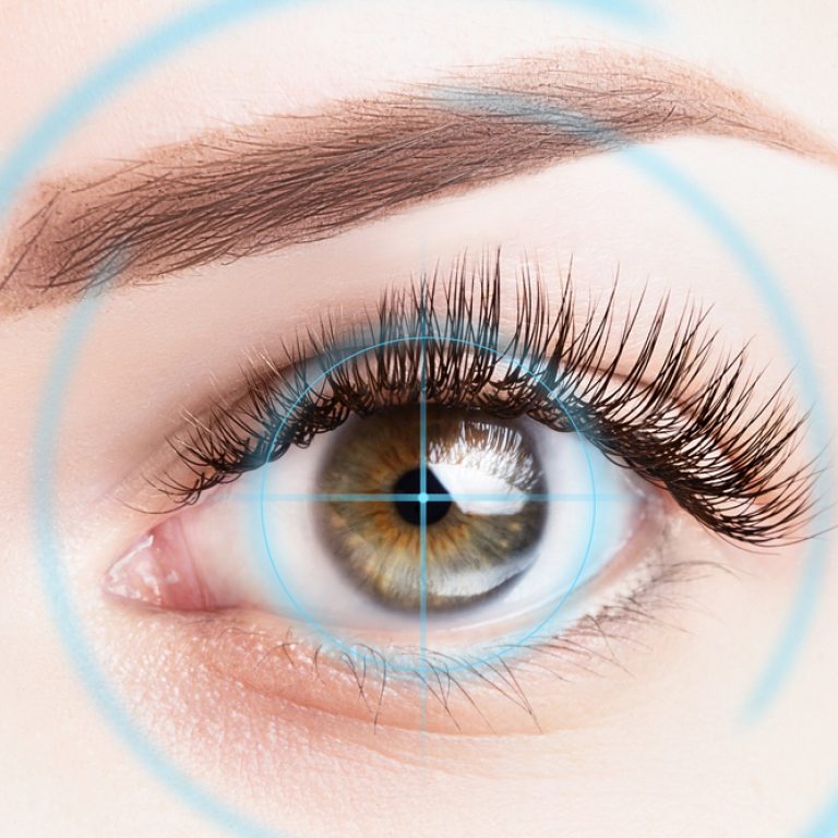 phau-thuat-khuc-xa-bang-laser